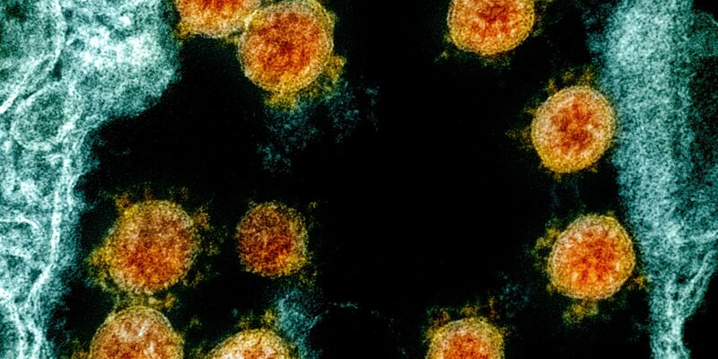 Elektronenmikroskopische Aufnahme des Coronavirus SARS-CoV-2. - Foto: Uncredited/NIAID/NIH/dpa