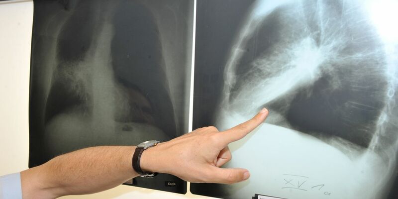 Die Untersuchung dauert nur wenige Minuten und ist schmerzfrei (Symbolbild). - Foto: Felix Hörhager/dpa