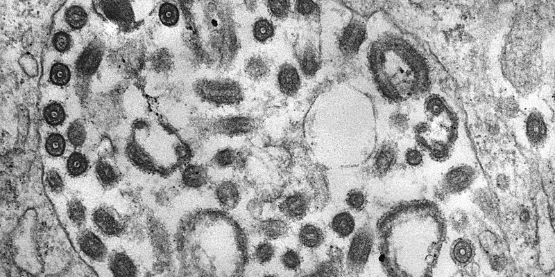 Die Transmissionselektronenmikroskopie (TEM) einer Gewebeprobe zeigt das Vorhandensein zahlreicher Marburg-Viruspartikel. - Foto: Fred Murphy/CDC/dpa