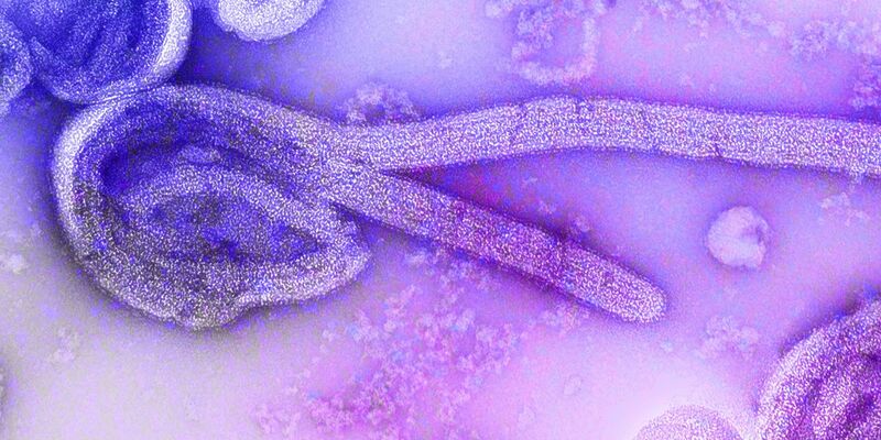 Eine elektronenmikroskopische Aufnahme eines Marburg-Virus. - Foto: Dr. Frederick Murphy/CDC/dpa