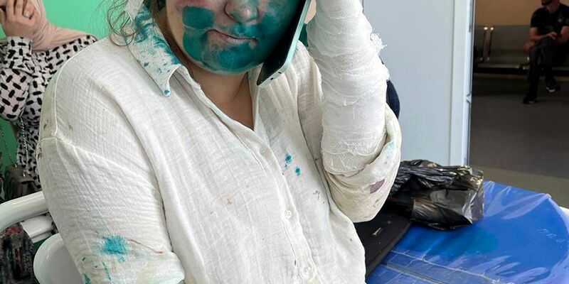 Die Journalistin Jelena Milaschina ist nach der Attacke in Tschetschenien von Kollegen nach Moskau gebracht worden. - Foto: Uncredited/Novaya Gazeta Europe Novayagazeta.eu/AP/dpa