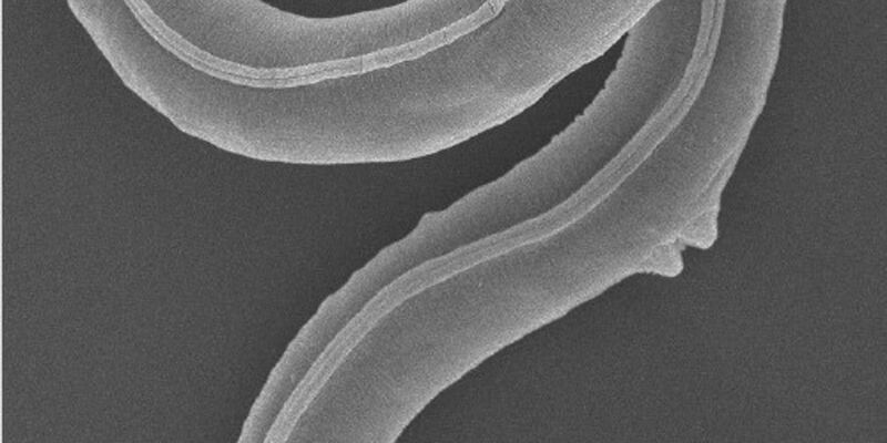 Ein Fadenwurm (Panagrolaimus kolymaensis) auf einem Rasterelektronenbild. - Foto: A. V. Tchesunov/A. Shatilovich/Institute of Physicochemical and Biological Problems in Soil Science RAS/dpa