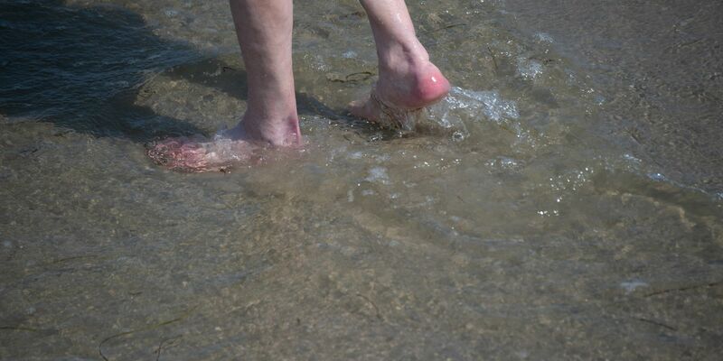 Ein 74-Jähriger starb nach einer Vibrionen-Infektion - hatte wohl auch offene Wunden und war chronisch krank. - Foto: Stefan Sauer/dpa