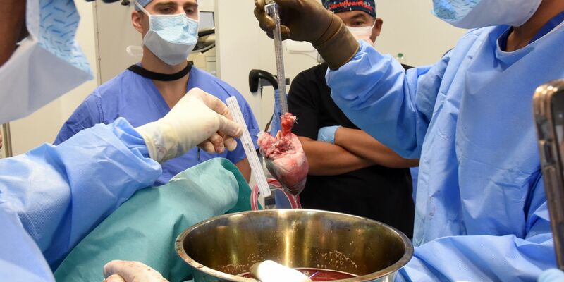 Chirurgen an der Uniklinik in Baltimore bereiten sich auf die Schweineherz-Transplantation vor. Es ist der weltweit zweite Eingriff dieser Art. - Foto: Mark Teske/University of Maryland School of Medicine/dpa