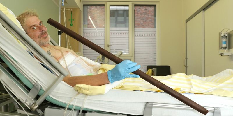 Patient Frank Vaorin liegt im Krankenhausbett und hält die Zaunstange in der Hand, die seinen Körper durchbohrte. - Foto: Kerstin Hase/Gesundheit Nord – Klinikverbund Bremen/dpa