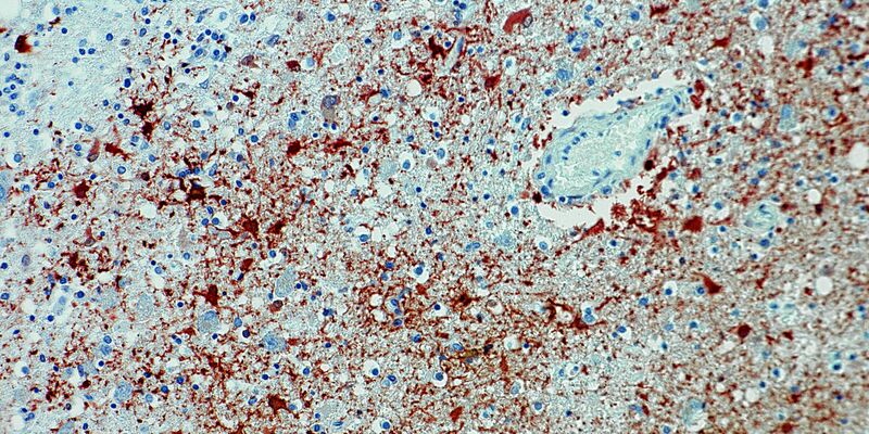 Die undatierte Aufnahme zeigt einen Anitkörpernachweis zum Borna-Virus im Gewebe. - Foto: Bernhard-Nocht-Institut für Tropenmedizin/dpa