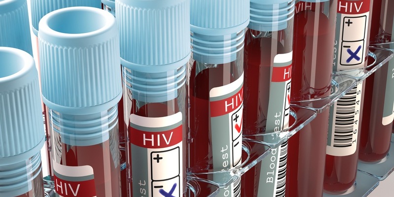 Mit HIV alt werden - Fortschritte in der AIDS-Therapie - Foto: presseportal.de