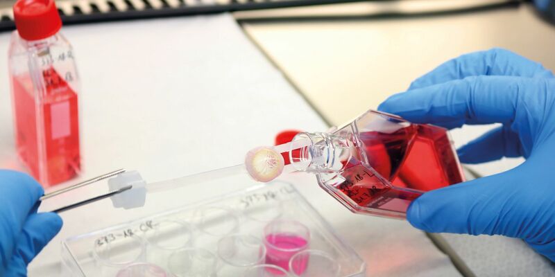 Ein Augenhornhaut-Transplantat wird von einem Labormitarbeitenden bearbeitet. - Foto: --/DGFG/dpa