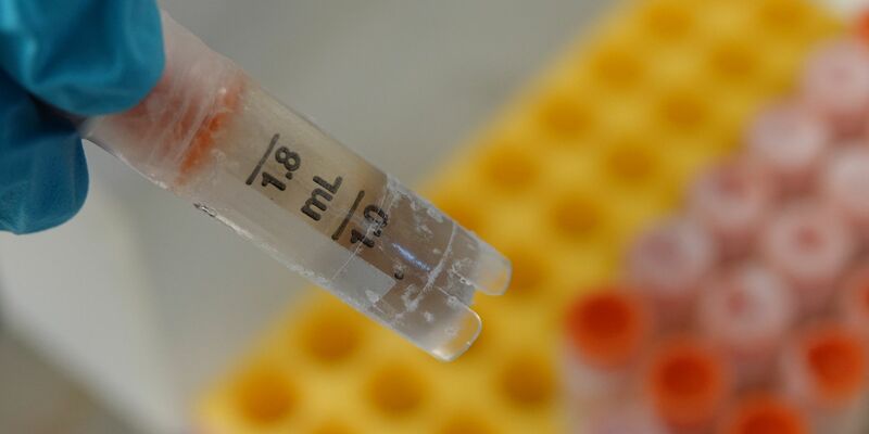 Eine eingefrorene Stuhlprobe in einem Gläschen. - Foto: Christiane Oelrich/dpa