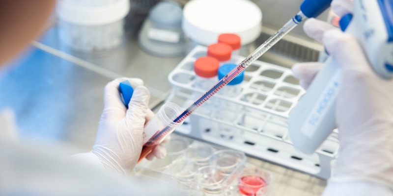 Wann schlägt eine Immuntherapie an? / Forscher nehmen die CAR-T-Zell-Therapie genau unter die Lupe - Foto: presseportal.de