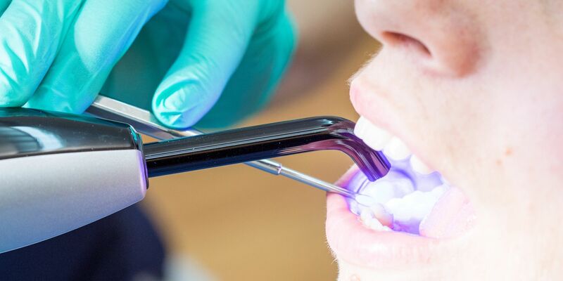 Laut KZBV-Vorstandschef Hendges gehen bei fachgerechtem Einsatz von Dentalamalgam keine Gesundheitsgefahren aus. - Foto: Christin Klose/dpa