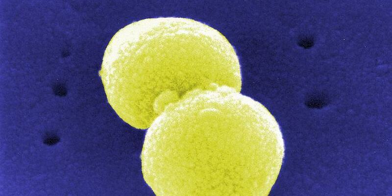 Streptococcus pneumoniae (Archiv) - Foto: über dts Nachrichtenagentur