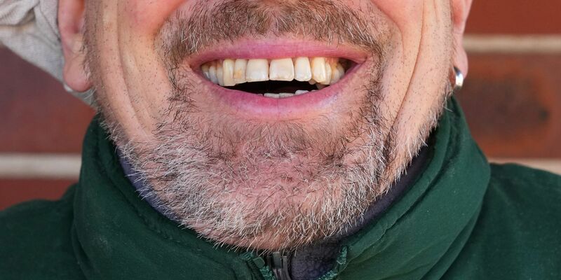 Könnte Lachen ein Therapieansatz werden? - Foto: Soeren Stache/dpa-Zentralbild/dpa