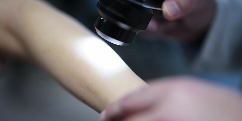 Ein Hautarzt untersucht bei einer Krebsvorsorgeuntersuchung eine Patientin mit einem Auflichtmikroskop. - Foto: Eva Manhart/apa/dpa