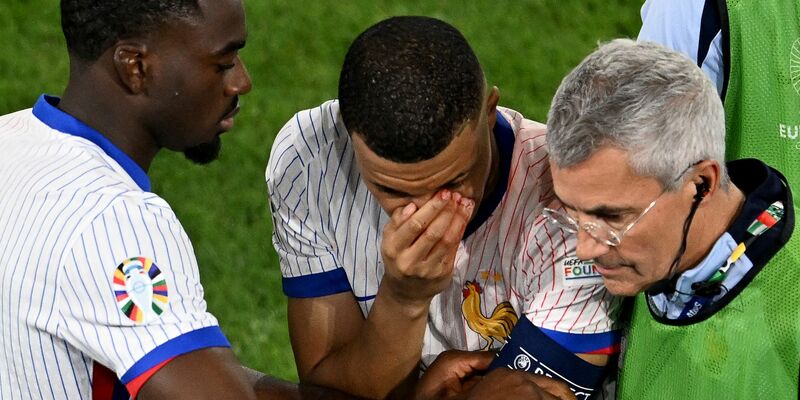 Mbappé (M) musste mit stark blutender Nase ausgewechselt werden. - Foto: Fabian Strauch/dpa