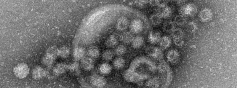 Das hochansteckende Norovirus verursacht einen plötzlich auftretenden, heftigen Brechdurchfall. - Foto: Gudrun Holland/RKI/Robert-Koch-Institut/dpa