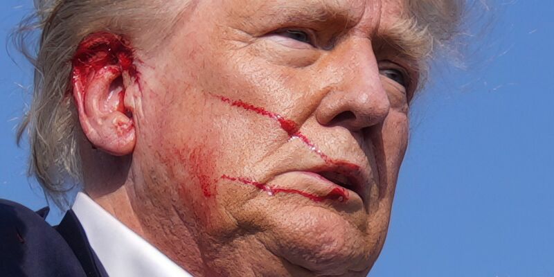 Die Schusswunde des republikanischen Präsidentschaftskandidaten Donald Trump verheilt nach Angaben seines Arztes gut. (Archivbild) - Foto: Evan Vucci/AP/dpa