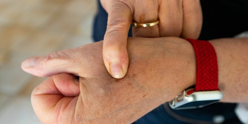 Die eingepflanzte Technik wird in Deutschland noch überwiegend abgelehnt. (Archivbild) - Foto: Philipp Schulze/dpa
