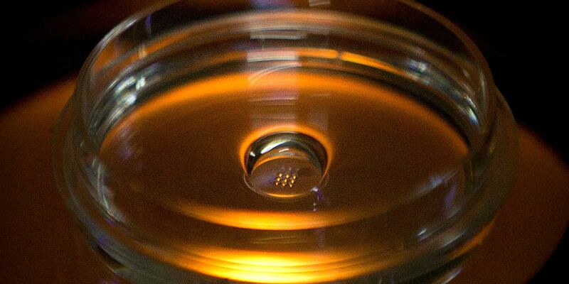 Fällt Deutschland in der Forschung zum Beispiel mit Embryonen zurück? (Archivbild) - Foto: Mark Schiefelbein/AP/dpa