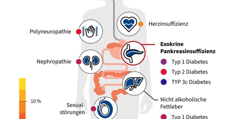 Unterschätzte Gefahr bei Diabetes mellitus: Unterzuckerungen durch Verdauungsenzymmangel - Foto: presseportal.de