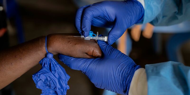 Die Zahl der Mpox-Fälle nimmt in mehreren afrikanischen Ländern weiter zu (Archivbild). - Foto: Moses Sawasawa/AP/dpa