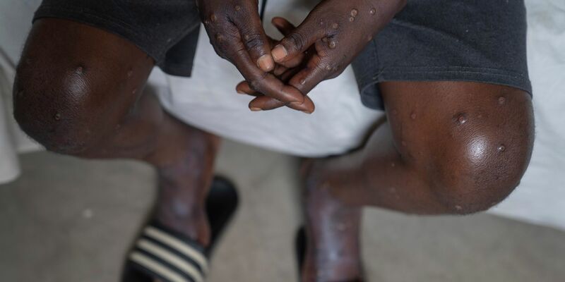 Impfstoff ist kein Allheilmittel, sagt die WHO. - Foto: Moses Sawasawa/AP/dpa