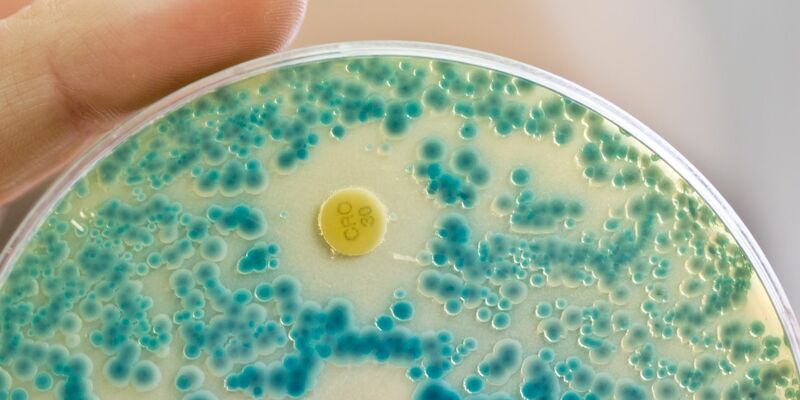 Indikatorkulturplatte zum Nachweis von resistenten Bakterien: Antibiotikaresistente Keime verursachen allein in der EU jährlich Zehntausende Todesfälle. (Symbolbild) - Foto: Daniel Karmann/dpa