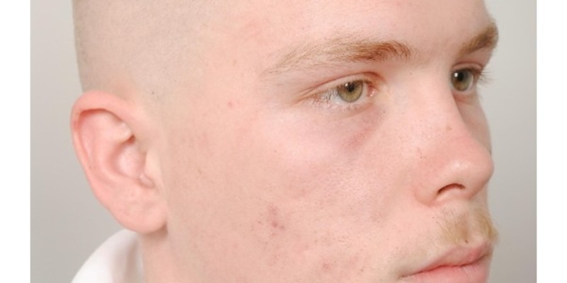 POL-H: Öffentlichkeitsfahndung: Polizei Hannover sucht mit Haftbefehl nach Joshua D. - Foto: presseportal.de