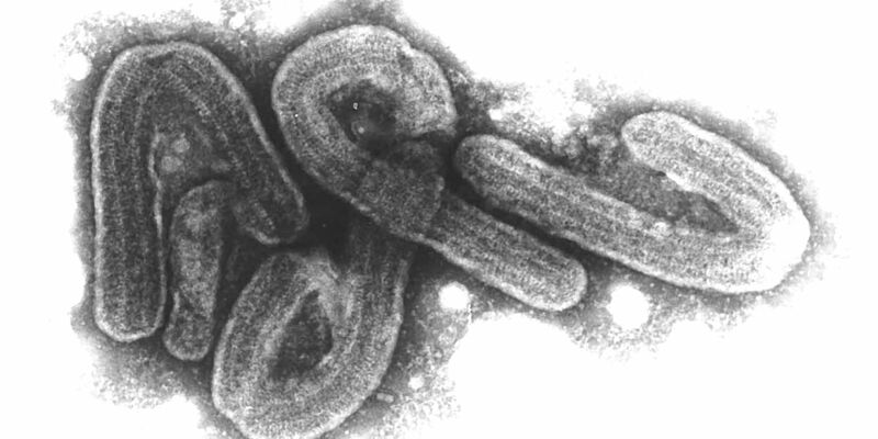 Eine elektronenmikroskopische Aufnahme des Marburg-Virus. - Foto: Bernhard-Nocht-Institut/dpa