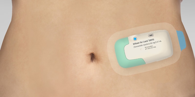 Gerresheimer: FDA erteilt Tentative Approval für Lasix von SQ Innovation® ONYU* - Foto: presseportal.de