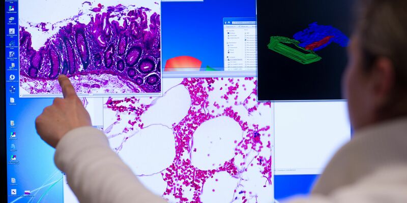 Deutlich weniger Menschen werden wegen Darmkrebs im Krankenhaus behandelt (Symbolfoto) - Foto: picture alliance / Bernd von Jutrczenka/dpa