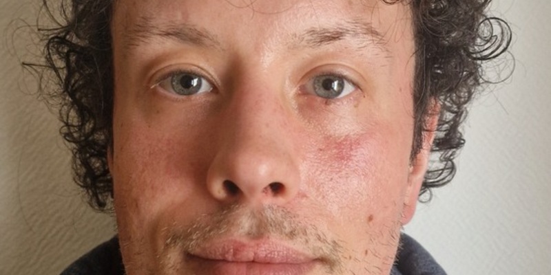 POL-GÖ: (33/2025) 37 Jahre alter Adrian W. aus Bad Sachsa seit Mittwoch vermisst - Foto: presseportal.de