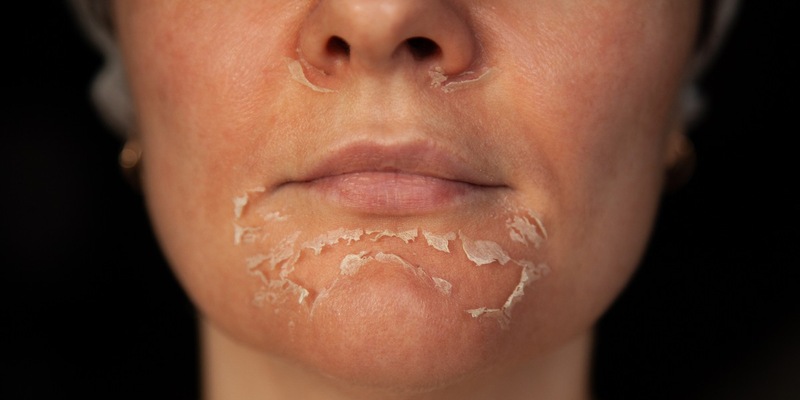 Evertz Pharma warnt: Kosmetik kann die Haut ruinieren! - Foto: presseportal.de