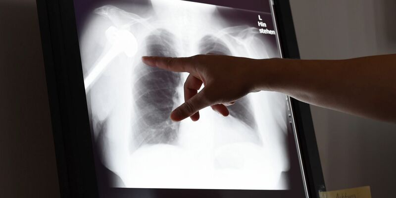 Gutachter überprüfen Behandlungen im Nachhinein auf Fehler (Foto: Archiv). - Foto: Susann Prautsch/dpa/dpa-tmn