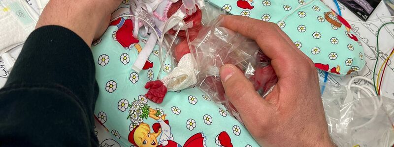Etwas mehr als ein Päckchen Butter wog die kleine Marie, als sie im Februar zur Welt kam. Seitdem ist das Kind gut gewachsen. - Foto: Privat/Kinderklinik Dritter Orden Passau/dpa