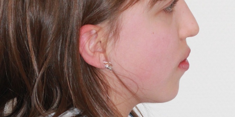 POL-RTK: Aktuelles Lichtbild der Vermissten 14-Jährigen - Foto: presseportal.de