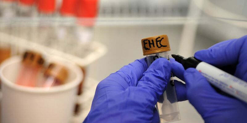 Rinder-Salami wird wegen einer möglichen bakteriellen Belastung zurückgerufen. (Symbolbild)  - Foto: picture alliance / dpa