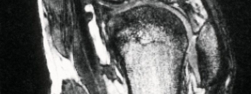 Schmerzen im Knie treiben viele Versicherte zum Orthopäden - viele kommen dort mit fragwürdigen Therapien in Kontakt. (Archivbild) - Foto: picture alliance / dpa