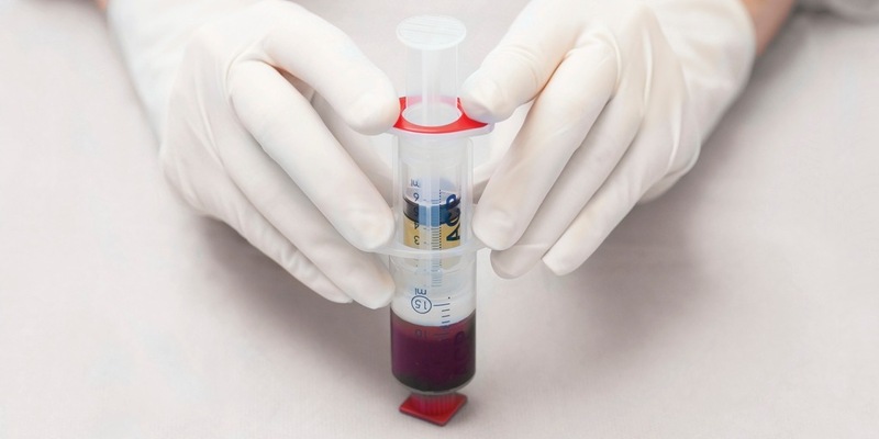 Bioregenerative Therapie von Arthrosen und Sportverletzungen - Mit ACP aus dem eigenen Blut direkt in Gelenke, Muskeln oder Sehnen - Foto: presseportal.de