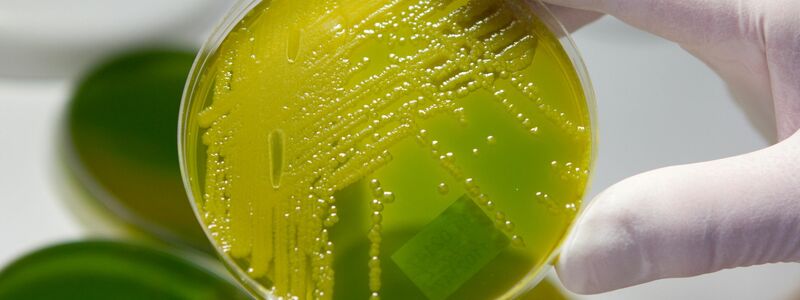 Ehec steht für enterohämorrhagische Escherichia coli und bezeichnet bestimmte krankmachende Stämme des Darm-Bakteriums, die vor allem bei Wiederkäuern wie Rindern vorkommen. (Archivbild) - Foto: Matthias Bein/dpa-Zentralbild/dpa