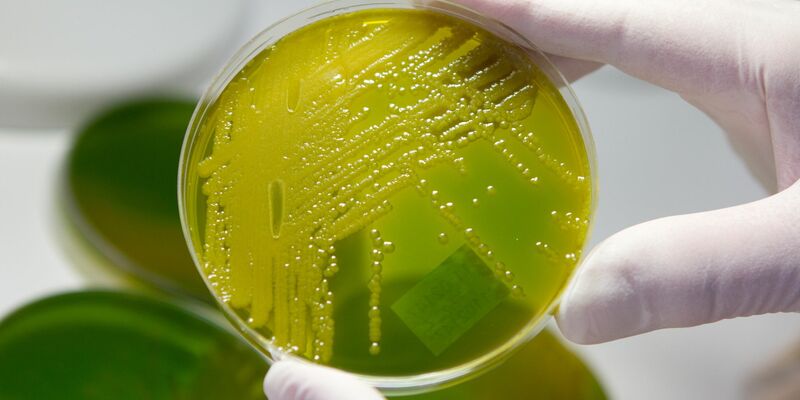 In Zwiebelmettwurst wurden die Bakterien nachgewiesen. (Archivbild)  - Foto: Matthias Bein/dpa-Zentralbild/dpa