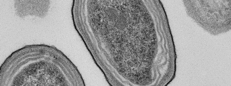 Elektronenmikroskopische Aufnahme von Prochlorococcus-Zellen. - Foto: Natalie Kellogg/dpa