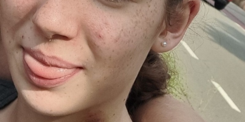 POL-SLS: Öffentlichkeitsfahndung nach vermissten 13-jährigen Mädchen aus Saarlouis - Foto: presseportal.de