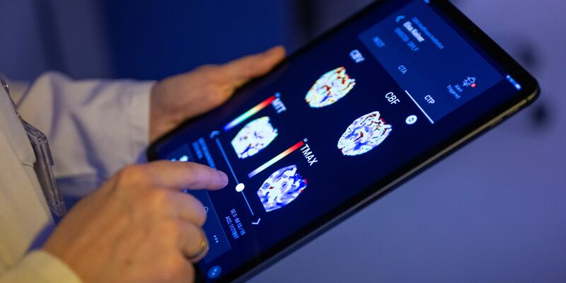 Gehirnbilder eines Patienten in einer KI-basierten App. Nach einer Deloitte-Umfrage sehen viele Bürgerinnen und Bürger den Einsatz von KI in der Medizin skeptisch, vor allem wenn es um die Therapie geht. (Symbolbild) - Foto: Monika Skolimowska/dpa