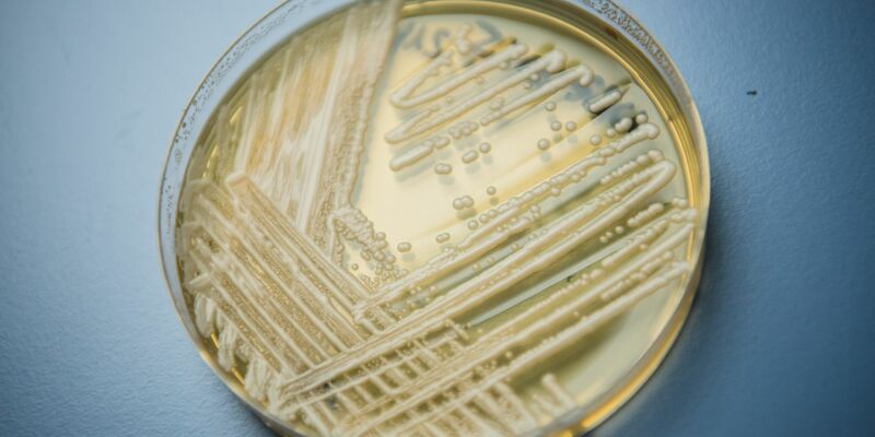Der Hefepilz Candidozyma auris (früher bekannt als Candida auris). - Foto: Nicolas Armer/dpa