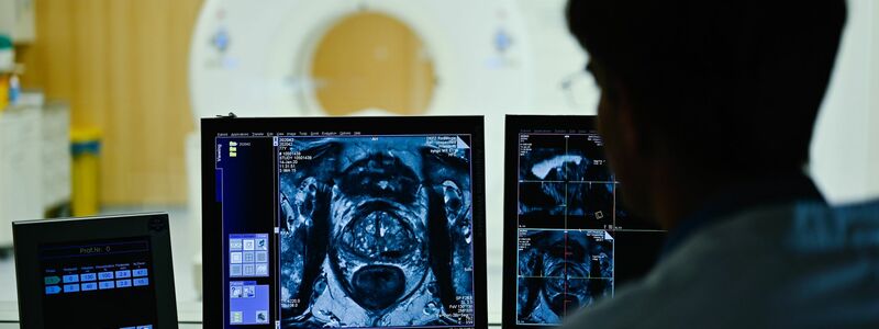 Nach dem Anfangsverdacht auf Prostatakrebs kommen im Verlauf einer Diagnostik auch bildgebende Verfahren zum Einsatz. (Archivbild) - Foto: Uwe Anspach/dpa/dpa-tmn