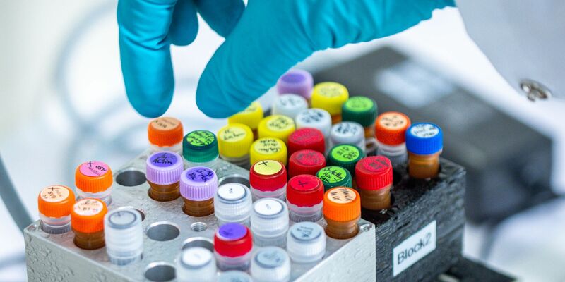 Ehec bezeichnet bestimmte krankmachende Stämme des Darm-Bakteriums, die vor allem bei Wiederkäuern wie Rindern vorkommen (Archivbild). - Foto: Jens Büttner/dpa