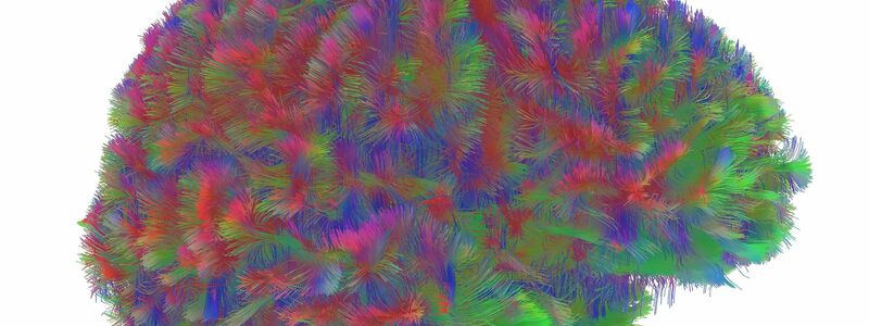 Sogenannte MRT-Diffusionsscans lassen deutliche Unterschiede der Hirnstruktur abhängig vom Alter erkennen. - Foto: Dr Alexa Mousley/University of Cambridge/dpa