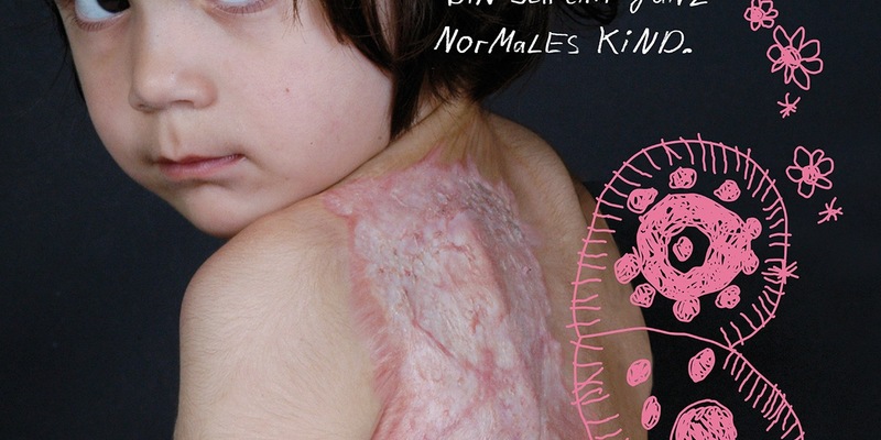 FW Weinheim: Tag des brandverletzten Kindes Gemeinsam Kraft geben, Prävention stärken - Foto: presseportal.de