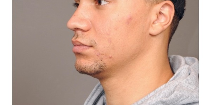 POL-H: Öffentlichkeitsfahndung: Verstoß gegen das Waffengesetz, Sachbeschädigung und Bedrohung - Wer kann Hinweise zum Aufenthaltsort von Luis Che B. (26) geben? - Foto: presseportal.de